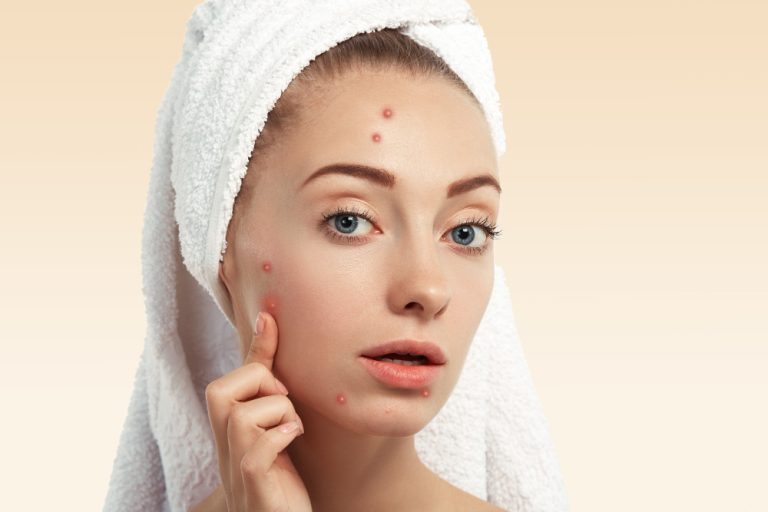 Best Skin Doctor in Sharjah providing expert diagnosis and treatment for acne, eczema, pigmentation, psoriasis, allergies, and other common skin conditions.